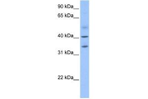 anti-Zinc Finger CCCH-Type Containing 14 (ZC3H14) (N-Term) antibody