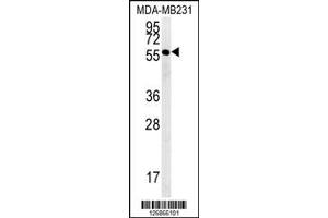Image no. 1 for anti-RAB11 Family Interacting Protein 2 (Class I) (RAB11FIP2) (Center) antibody (ABIN2496052)