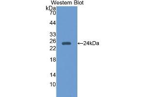 Image no. 1 for anti-Peroxiredoxin 5 (PRDX5) (AA 1-213) antibody (ABIN1176492)