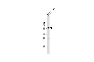 Image no. 3 for anti-Transforming Growth Factor, beta Receptor 1 (TGFBR1) (AA 145-172) antibody (ABIN1881880)