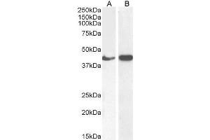 Image no. 11 for anti-Actin, alpha 2, Smooth Muscle, Aorta (ACTA2) (N-Term) antibody (ABIN185271)