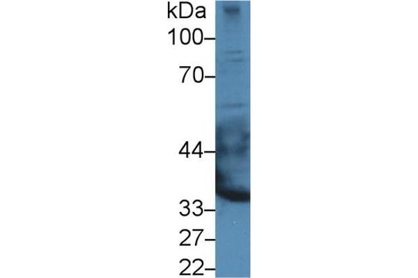 EPYC antibody  (AA 130-322)