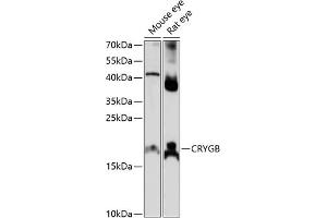 CRYGB 抗体  (AA 80-135)