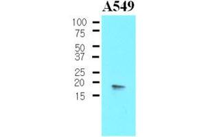 Image no. 1 for anti-Protein Phosphatase 1, Regulatory (Inhibitor) Subunit 14A (PPP1R14A) (AA 1-147), (N-Term) antibody (ABIN302213)