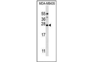 Image no. 2 for anti-Mitochondrial Ribosomal Protein L50 (MRPL50) (AA 118-147), (C-Term) antibody (ABIN953511)