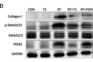 Image no. 37 for anti-Glyceraldehyde-3-Phosphate Dehydrogenase (GAPDH) antibody (ABIN3020541)