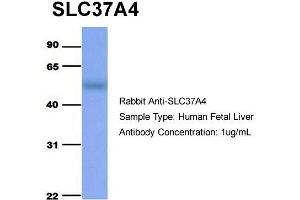 Image no. 3 for anti-Solute Carrier Family 37 (Glucose-6-Phosphate Transporter), Member 4 (SLC37A4) (Middle Region) antibody (ABIN2781570)