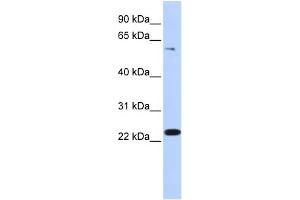 WB Suggested Anti-ZNF460 Antibody Titration:  0.