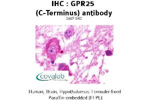 anti-G Protein-Coupled Receptor 25 (GPR25) (C-Term) antibody