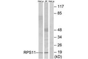 Image no. 1 for anti-Ribosomal Protein S11 (RPS11) (AA 71-120) antibody (ABIN1534538)
