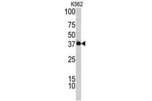 Image no. 1 for anti-Complement Factor H-Related 1 (CFHR1) (C-Term) antibody (ABIN452839)