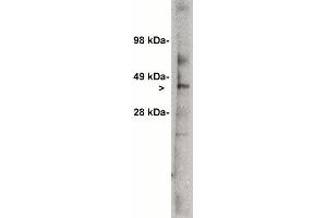 Image no. 1 for anti-UDP-Glucose Ceramide Glucosyltransferase (UGCG) antibody (ABIN306948)