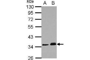 anti-Protein Phosphatase 1J (PPM1J) (Center) antibody