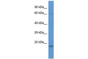 Image no. 1 for anti-LSM Domain Containing 1 (LSMD1) (AA 60-109) antibody (ABIN6746832)