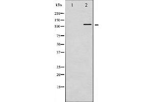 Image no. 1 for anti-Vinculin (VCL) (pTyr821) antibody (ABIN6256040)
