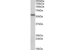 Western Blotting (WB) image for Desmin (DES) peptide (ABIN369745)