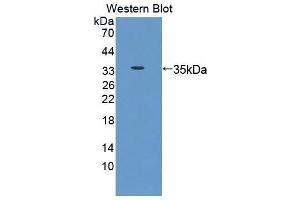 Image no. 1 for anti-BCL6 Co-Repressor (BCOR) (AA 1501-1755) antibody (ABIN5013230)