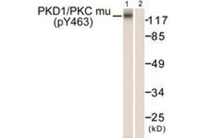 Western blot analysis of extracts from HepG2 cells, using PKD1/PKC mu (Phospho-Tyr463) Antibody.