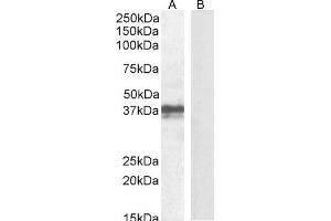 Image no. 1 for anti-Forkhead Box I3 (FOXI3) (Internal Region) antibody (ABIN625827)