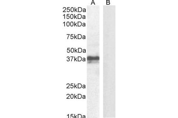 anti-Forkhead Box I3 (FOXI3) (Internal Region) antibody