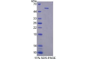 Image no. 1 for Leucine Rich Repeat Neuronal 1 (LRRN1) (AA 418-631) protein (His tag,GST tag) (ABIN6238362)