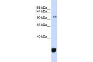 Image no. 1 for anti-F-Box Protein 10 (FBXO10) (AA 324-373) antibody (ABIN6743262)