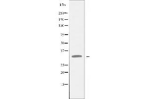 Image no. 2 for anti-E3 Ubiquitin-Protein Ligase SIAH1 (SIAH1) antibody (ABIN6258134)
