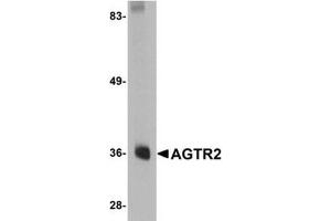 Image no. 2 for anti-Angiotensin II Receptor, Type 2 (AGTR2) (Center) antibody (ABIN2967340)