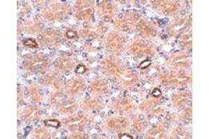 Image no. 3 for anti-Notum Pectinacetylesterase Homolog (NOTUM) (N-Term) antibody (ABIN6657113)