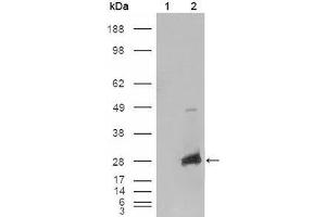 Image no. 1 for anti-Crystallin, alpha B (CRYAB) (AA 1-175) antibody (ABIN1724688)