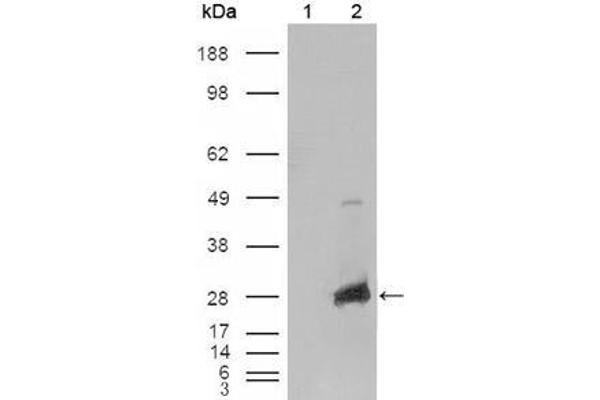 anti-Crystallin, alpha B (CRYAB) (AA 1-175) antibody