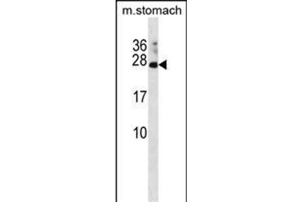 RAP2C anticorps  (N-Term)