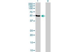 Western Blot analysis of FBXO38 expression in transfected 293T cell line by FBXO38 MaxPab polyclonal antibody.