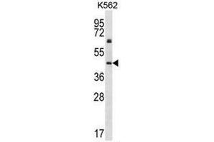 Image no. 2 for anti-Keratin 12 (KRT12) (AA 449-479), (C-Term) antibody (ABIN951810)