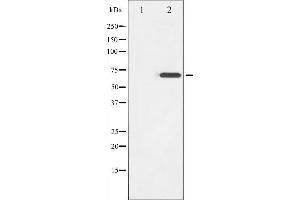 anti-zeta-Chain (TCR) Associated Protein Kinase 70kDa (ZAP70) (pTyr319) antibody