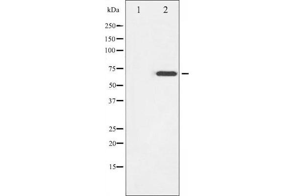anti-zeta-Chain (TCR) Associated Protein Kinase 70kDa (ZAP70) (pTyr319) antibody