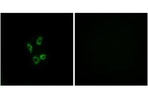Image no. 1 for anti-Cytochrome P450, Family 4, Subfamily Z, Polypeptide 1 (CYP4Z1) (AA 71-120) antibody (ABIN1534401)