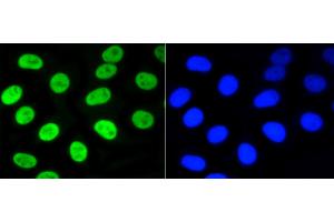 Image no. 2 for anti-Nuclear Factor (erythroid-Derived 2)-Like 2 (NFE2L2) (pSer40) antibody (ABIN5557501)