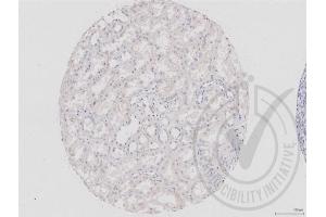 Image no. 1 for anti-Dishevelled Segment Polarity Protein 1 (DVL1) (AA 21-100) antibody (ABIN670671)