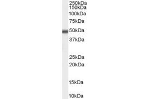 Image no. 2 for anti-Methyl-CpG Binding Domain Protein 2 (MBD2) (Internal Region) antibody (ABIN334432)