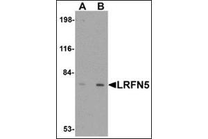 Image no. 2 for anti-Leucine Rich Repeat and Fibronectin Type III Domain Containing 5 (LRFN5) (C-Term) antibody (ABIN500194)