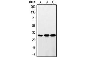 Image no. 2 for anti-Ring Finger Protein 144A (RNF144A) (Center) antibody (ABIN2706965)