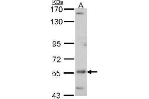 Image no. 1 for anti-AarF Domain Containing Kinase 4 (ADCK4) (Center) antibody (ABIN2856537)