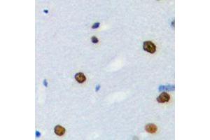 Image no. 1 for anti-Heterogeneous Nuclear Ribonucleoprotein L-Like (HNRPLL) (Center) antibody (ABIN2706323)