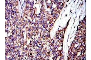 Image no. 5 for anti-V-Crk Sarcoma Virus CT10 Oncogene Homolog (Avian) (CRK) antibody (ABIN969062)