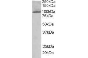 Image no. 2 for anti-TAO Kinase 3 (TAOK3) (Internal Region) antibody (ABIN185273)