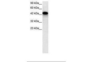 Image no. 2 for anti-Eyes Absent Homolog 3 (EYA3) (AA 277-326) antibody (ABIN6735802)