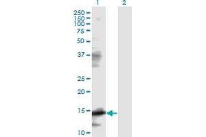 Image no. 1 for anti-Eukaryotic Translation Initiation Factor 5A (EIF5A) (AA 1-154) antibody (ABIN947825)