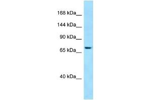 Image no. 1 for anti-SET Binding Factor 1 (SBF1) (C-Term) antibody (ABIN2789964)