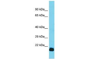 Image no. 1 for anti-Glutathione Peroxidase 7 (GPX7) (C-Term) antibody (ABIN2774105)